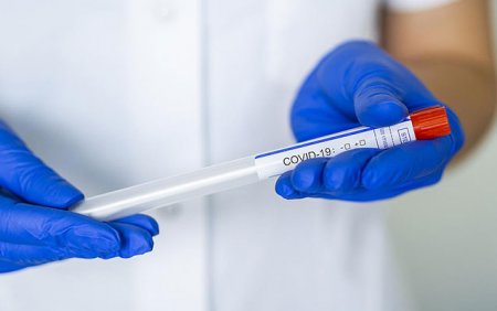 Azərbaycanda koronavirusa yoluxanların sayı kəskin azaldı